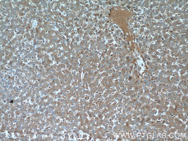 CTBS Antibody in Immunohistochemistry (Paraffin) (IHC (P))