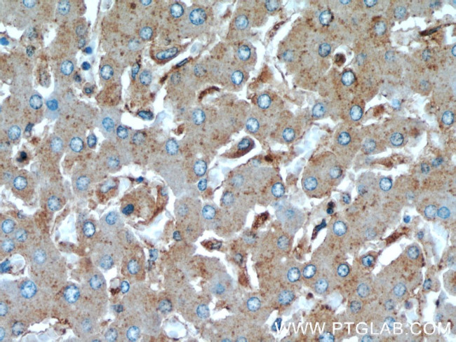 CTBS Antibody in Immunohistochemistry (Paraffin) (IHC (P))