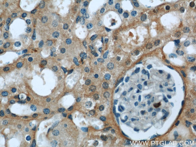 CTBS Antibody in Immunohistochemistry (Paraffin) (IHC (P))