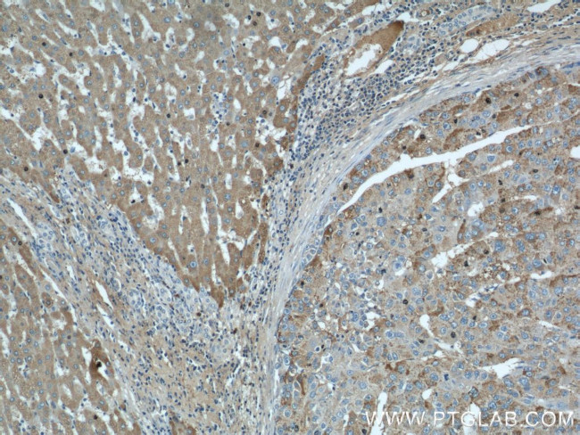 CTBS Antibody in Immunohistochemistry (Paraffin) (IHC (P))