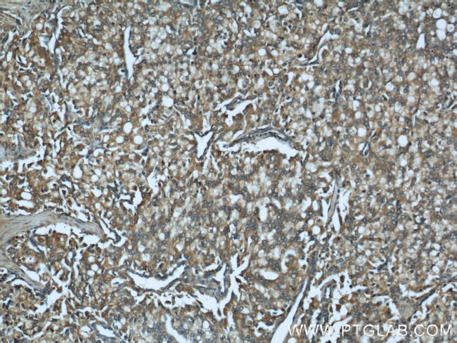 CTBS Antibody in Immunohistochemistry (Paraffin) (IHC (P))