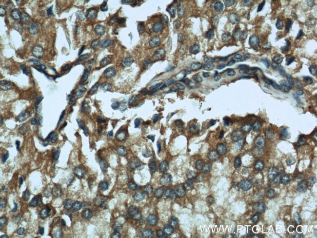 CTBS Antibody in Immunohistochemistry (Paraffin) (IHC (P))