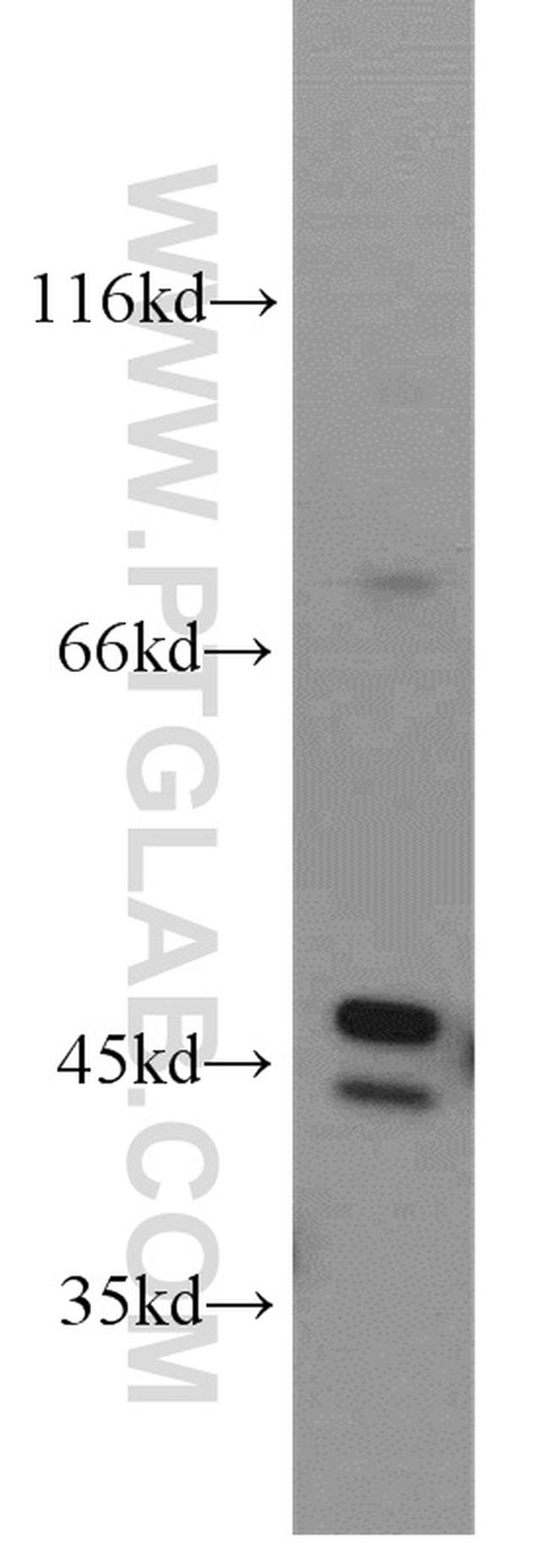 CTBS Antibody in Western Blot (WB)