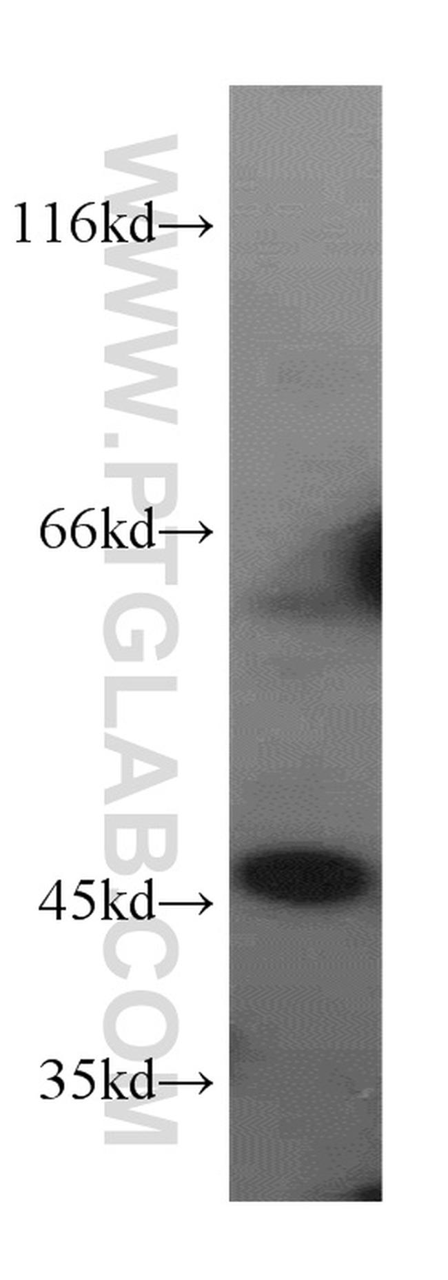 CTBS Antibody in Western Blot (WB)