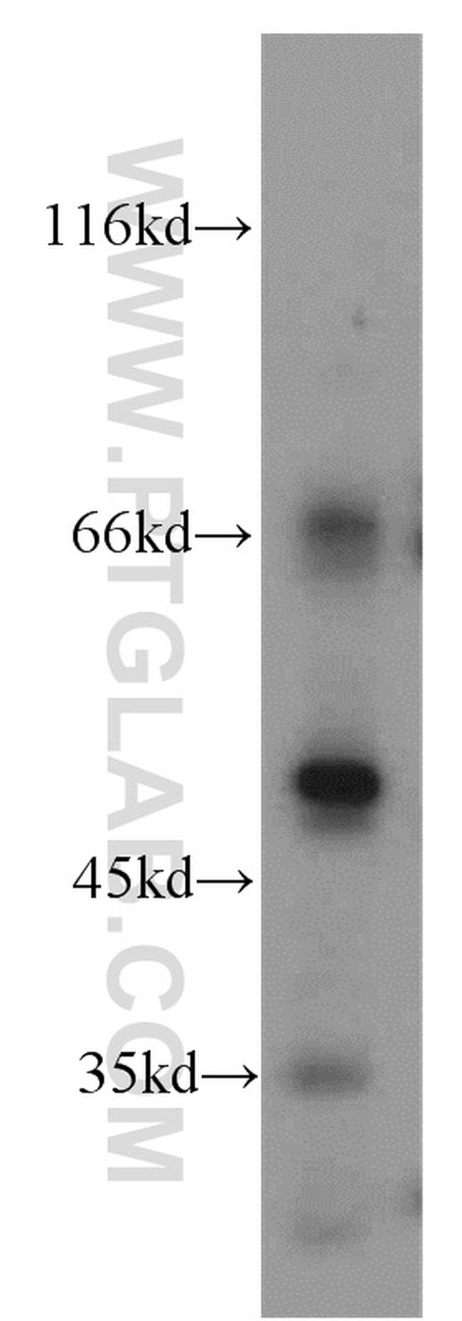 CTBS Antibody in Western Blot (WB)