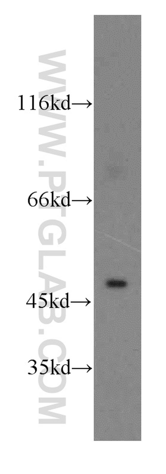 CTBS Antibody in Western Blot (WB)