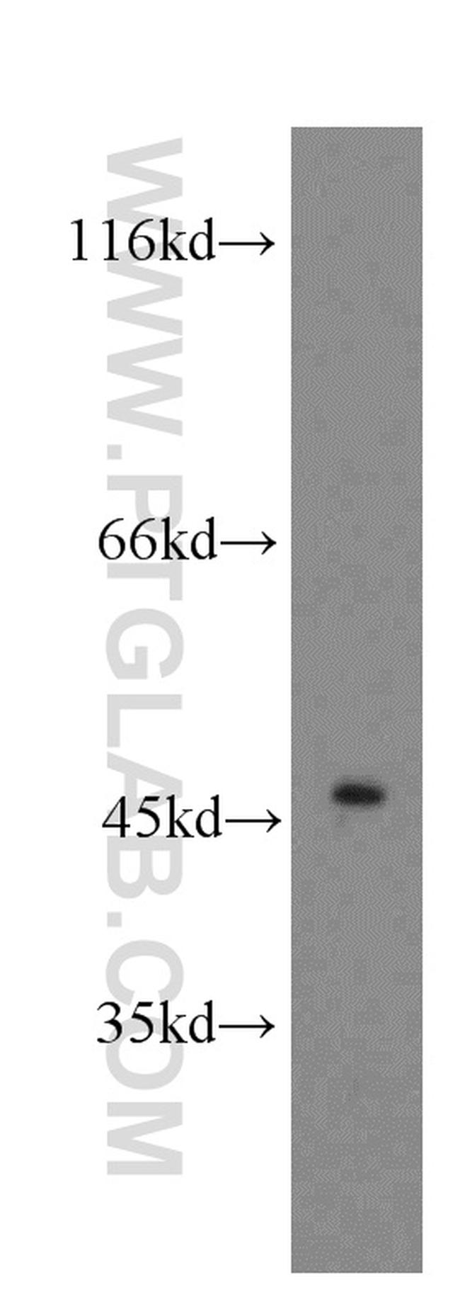 CTBS Antibody in Western Blot (WB)