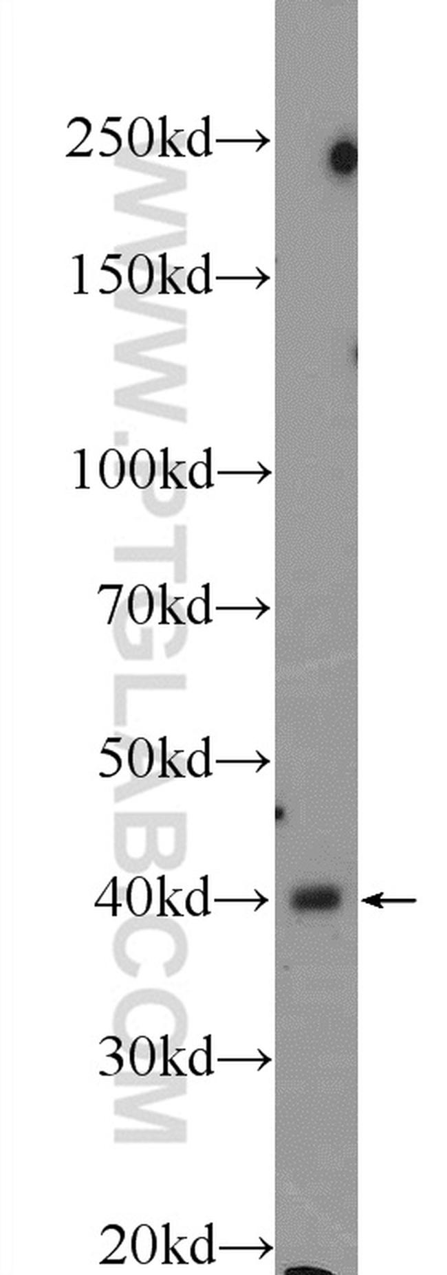 CTBS Antibody in Western Blot (WB)