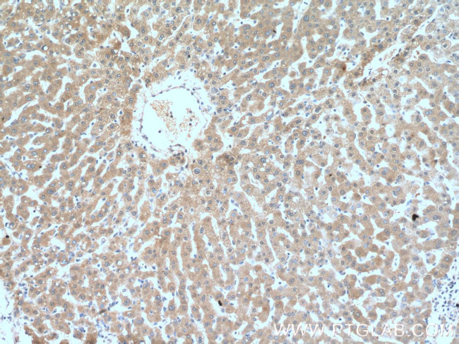 GCLC Antibody in Immunohistochemistry (Paraffin) (IHC (P))