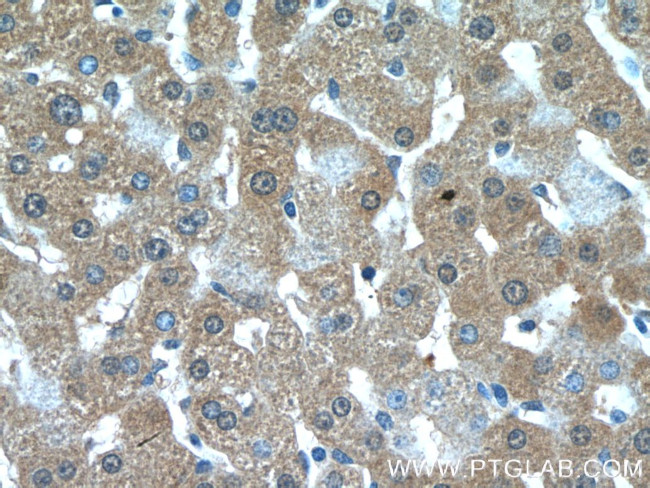 GCLC Antibody in Immunohistochemistry (Paraffin) (IHC (P))