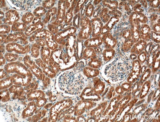 GCLC Antibody in Immunohistochemistry (Paraffin) (IHC (P))