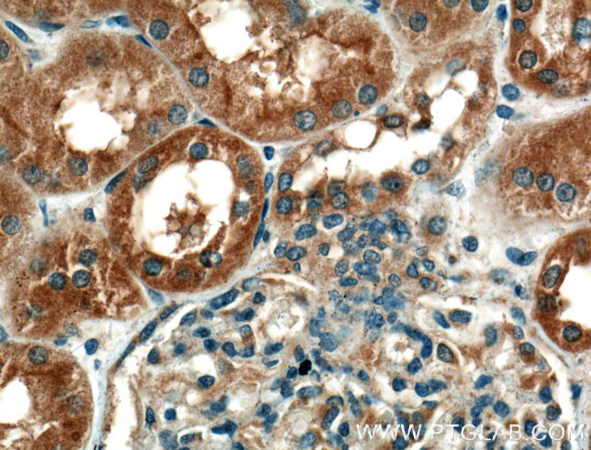 GCLC Antibody in Immunohistochemistry (Paraffin) (IHC (P))