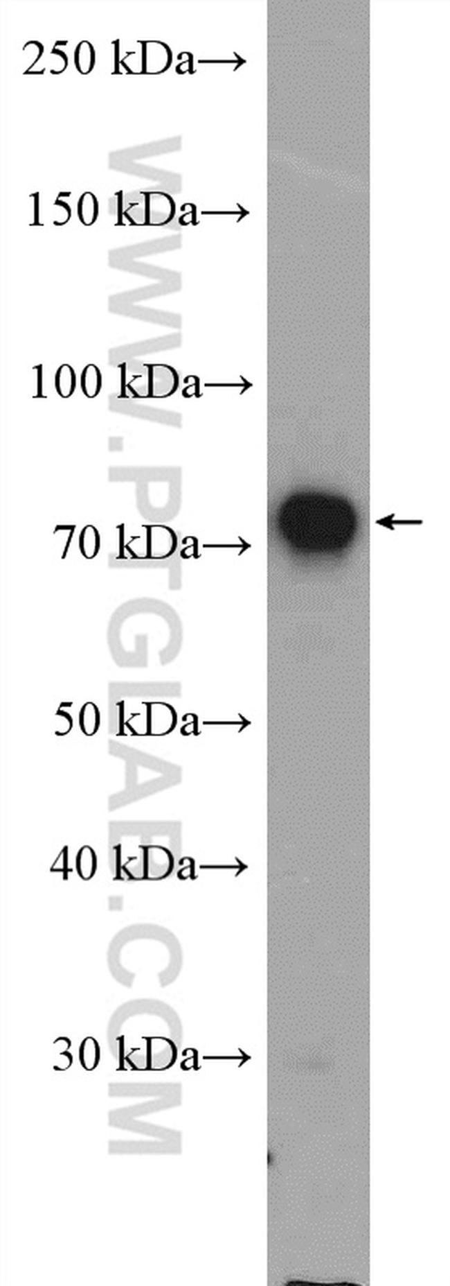 GCLC Antibody in Western Blot (WB)