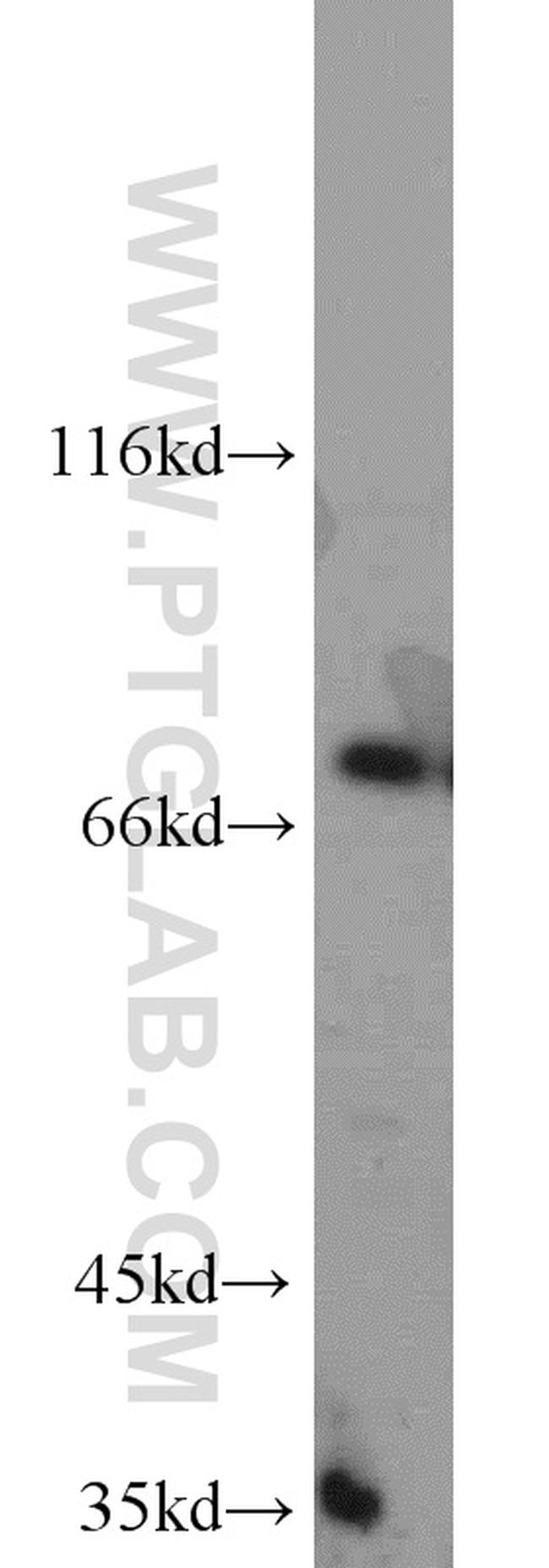 GCLC Antibody in Western Blot (WB)