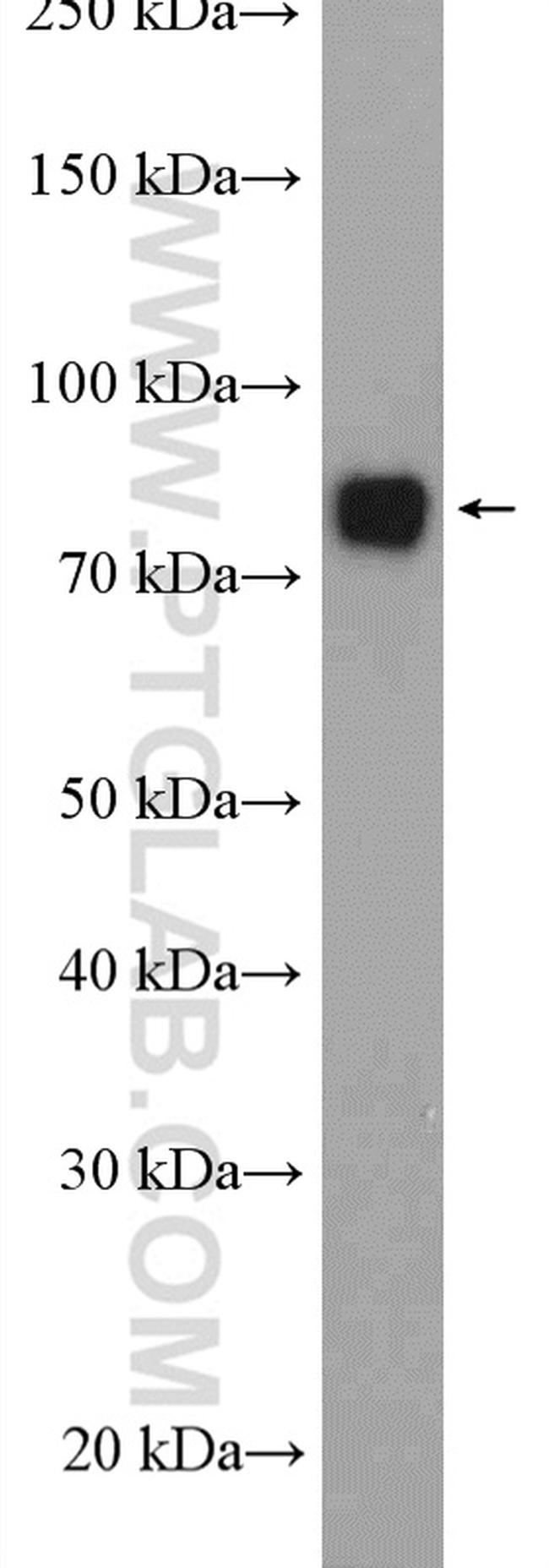 GCLC Antibody in Western Blot (WB)