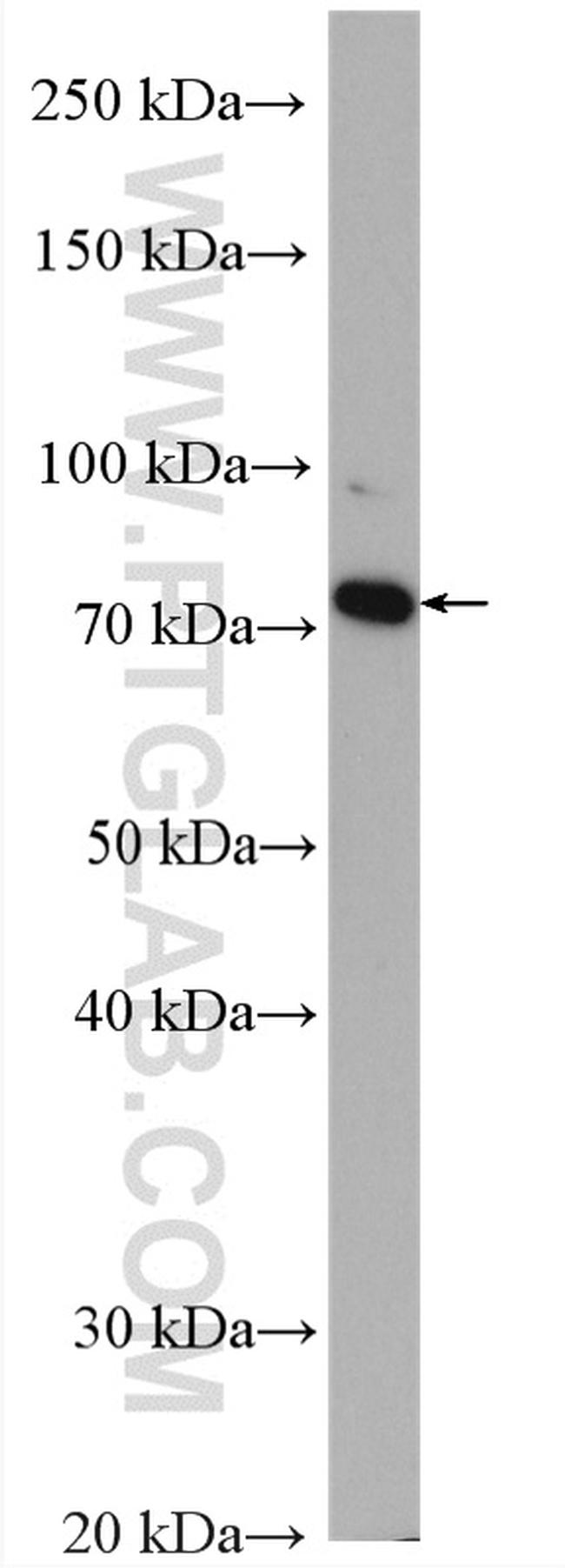 GCLC Antibody in Western Blot (WB)