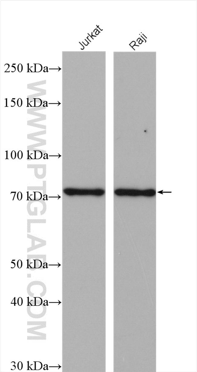 GCLC Antibody in Western Blot (WB)