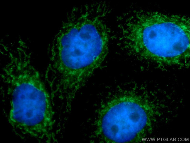 IFIT2 Antibody in Immunocytochemistry (ICC/IF)