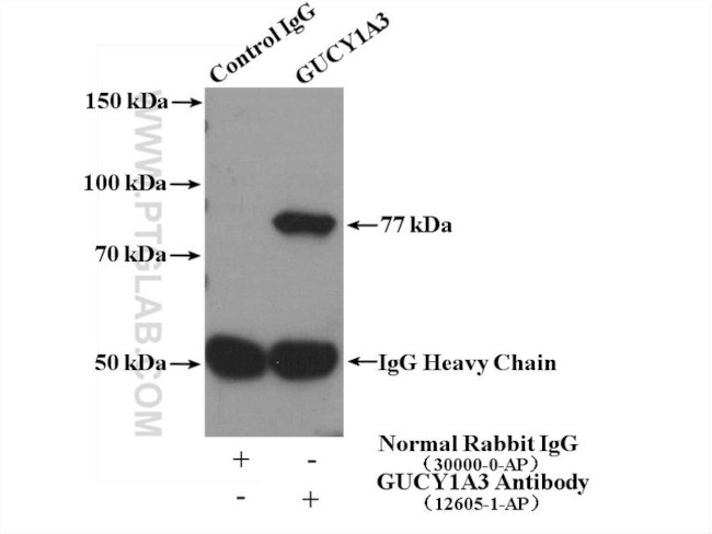 GUCY1A3 Antibody in Immunoprecipitation (IP)