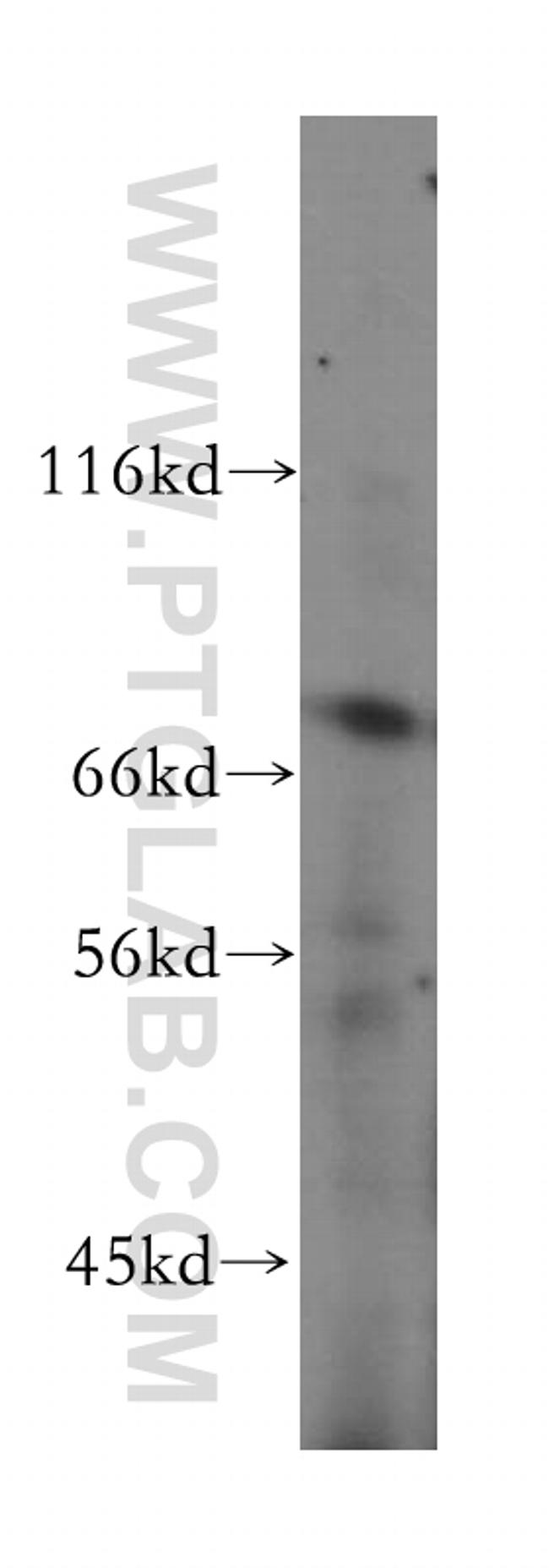 GUCY1A3 Antibody in Western Blot (WB)