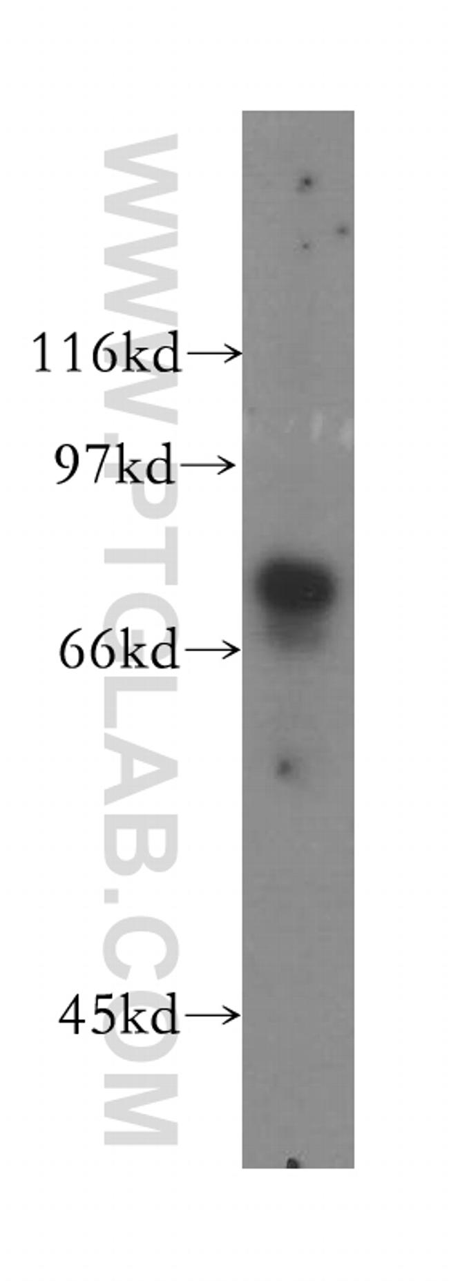 GUCY1A3 Antibody in Western Blot (WB)