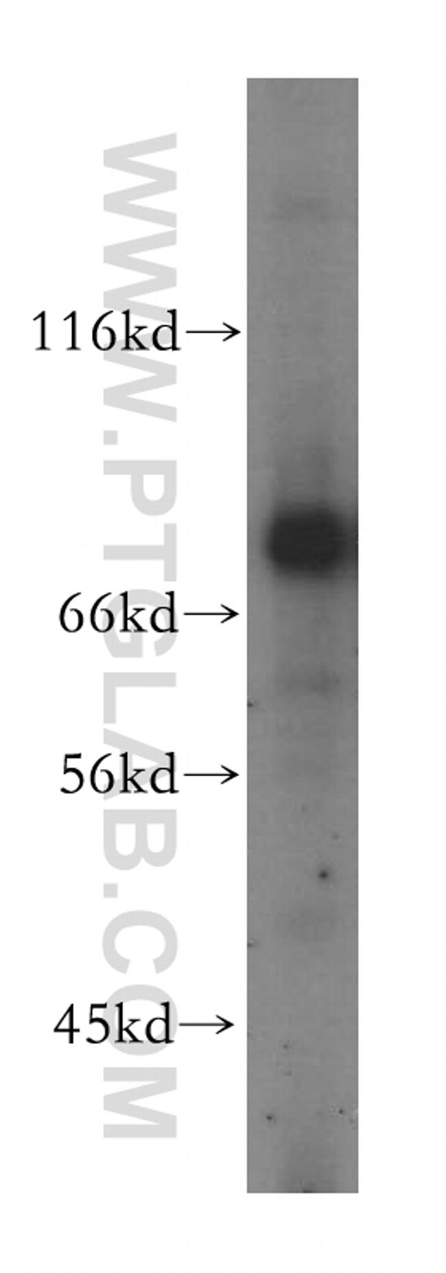 GUCY1A3 Antibody in Western Blot (WB)