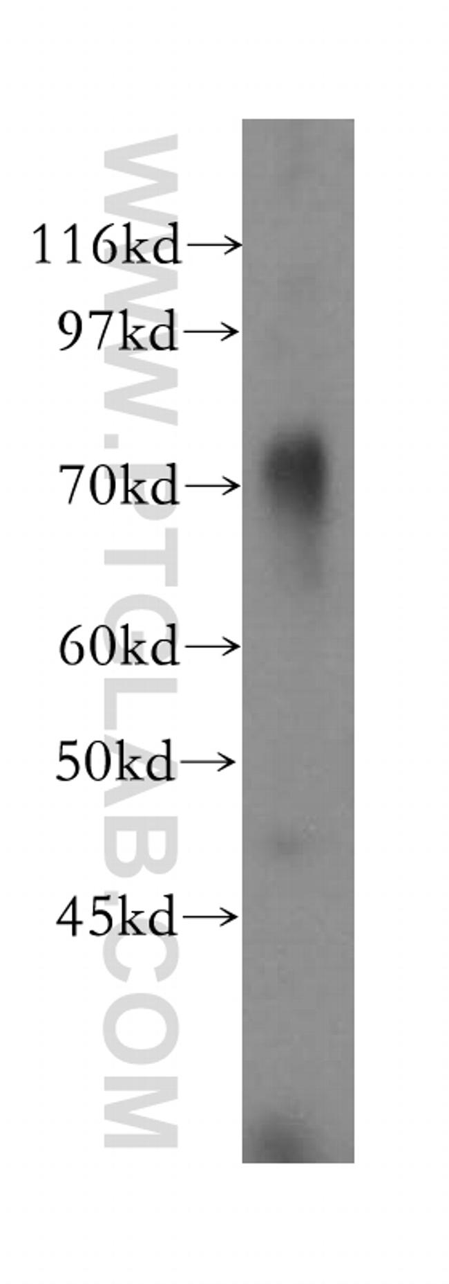 GUCY1A3 Antibody in Western Blot (WB)