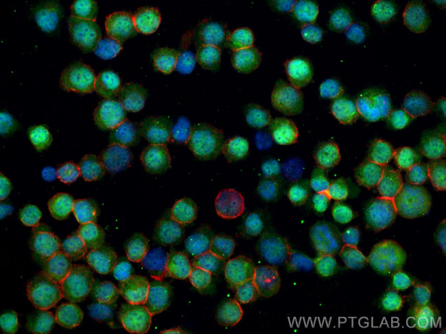 WT1 Antibody in Immunocytochemistry (ICC/IF)