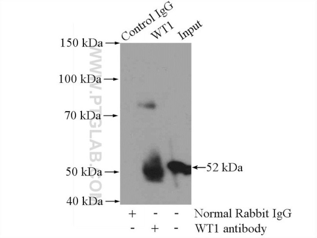 WT1 Antibody in Immunoprecipitation (IP)