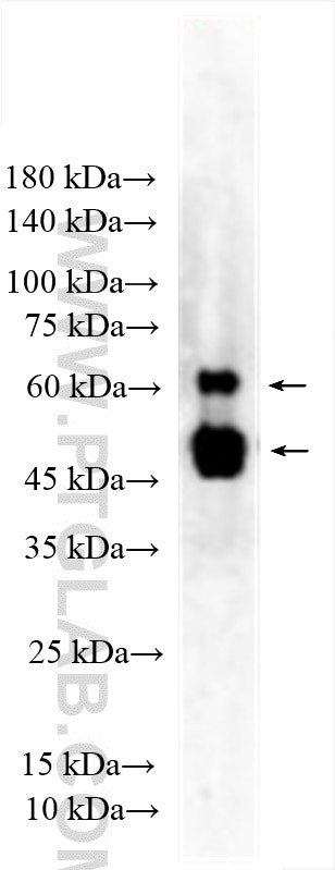 WT1 Antibody in Western Blot (WB)