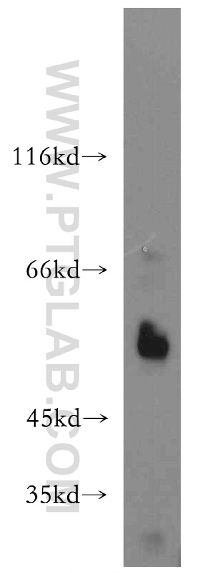 WT1 Antibody in Western Blot (WB)