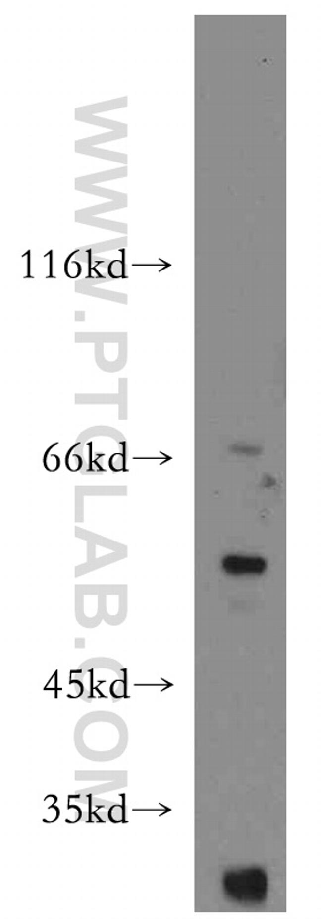 WT1 Antibody in Western Blot (WB)