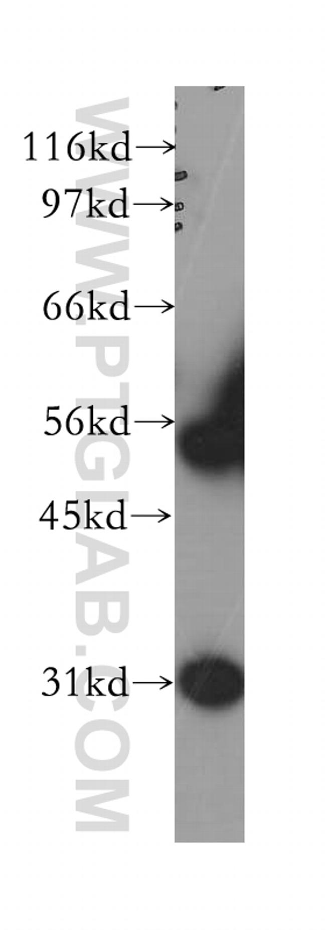 WT1 Antibody in Western Blot (WB)