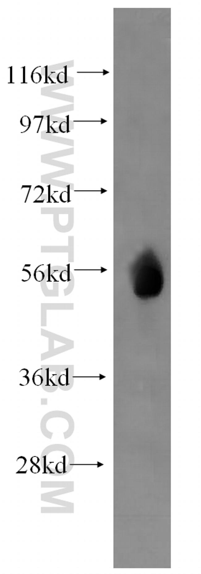 WT1 Antibody in Western Blot (WB)