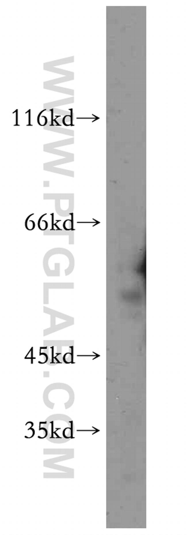 WT1 Antibody in Western Blot (WB)