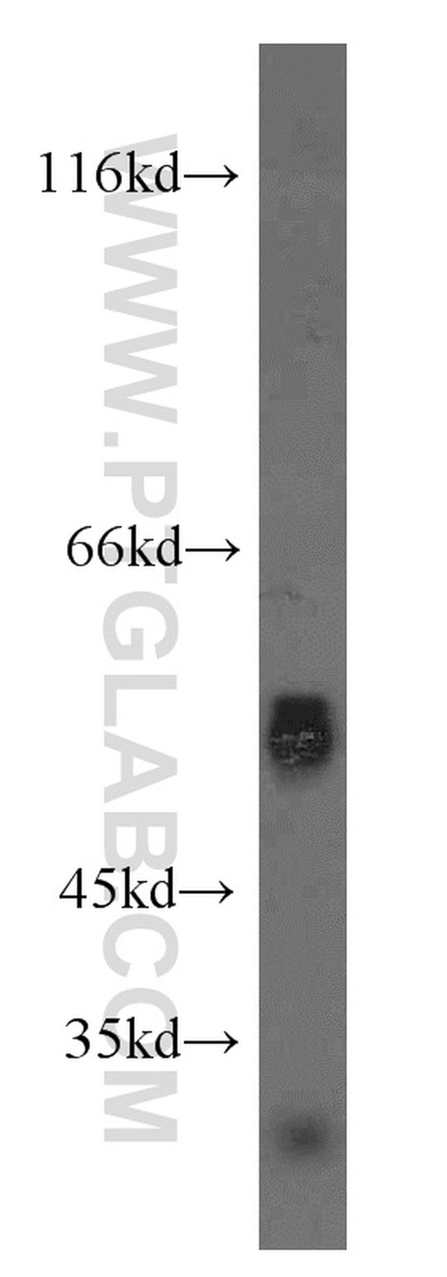 WT1 Antibody in Western Blot (WB)