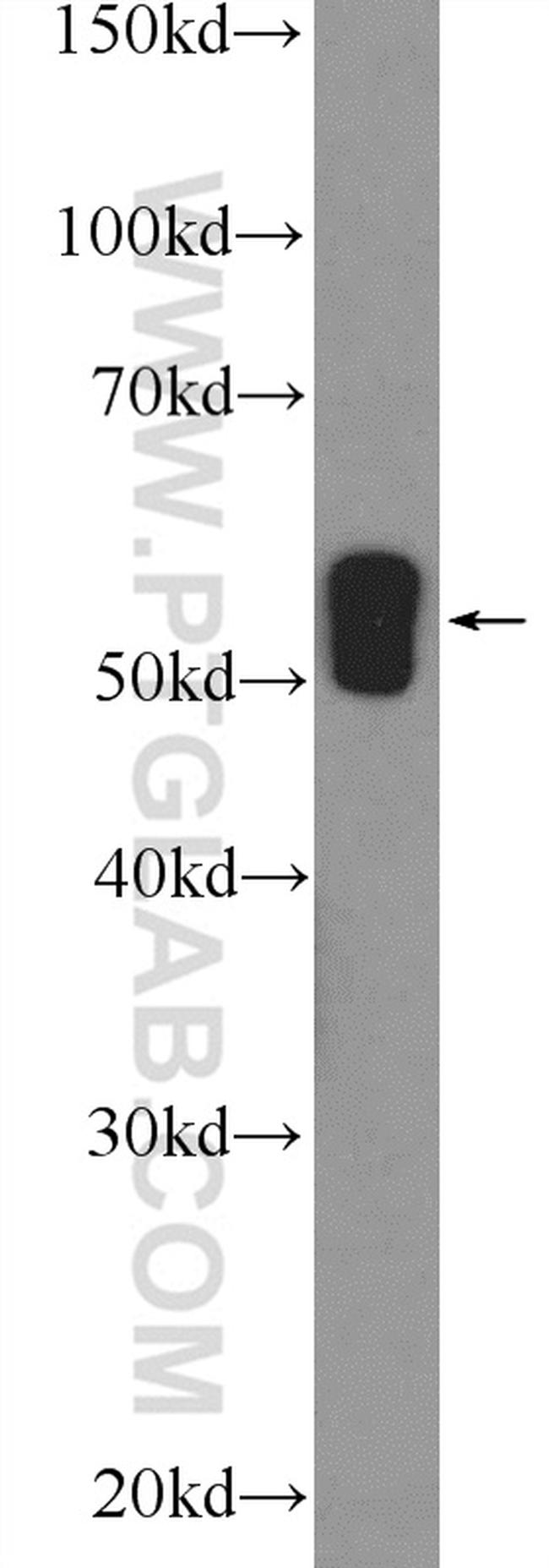 WT1 Antibody in Western Blot (WB)