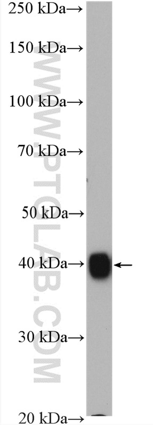 GNAI1 Antibody in Western Blot (WB)