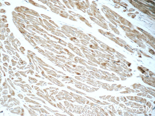 Cadherin-13 Antibody in Immunohistochemistry (Paraffin) (IHC (P))