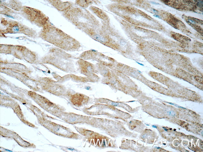 Cadherin-13 Antibody in Immunohistochemistry (Paraffin) (IHC (P))