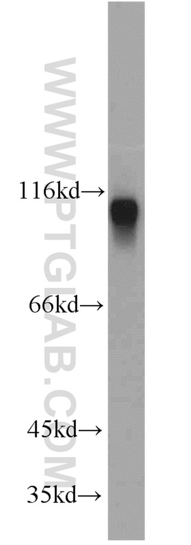 Cadherin-13 Antibody in Western Blot (WB)