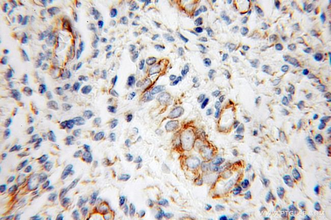 Cadherin-13 Antibody in Immunohistochemistry (Paraffin) (IHC (P))