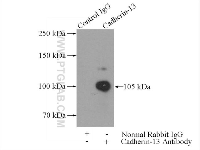 Cadherin-13 Antibody in Immunoprecipitation (IP)