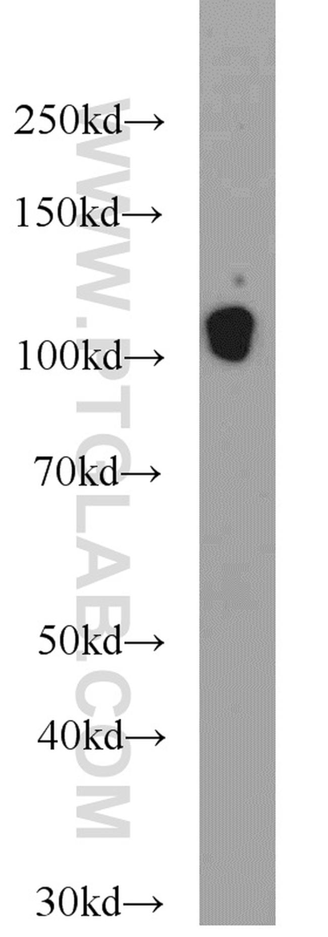 Cadherin-13 Antibody in Western Blot (WB)