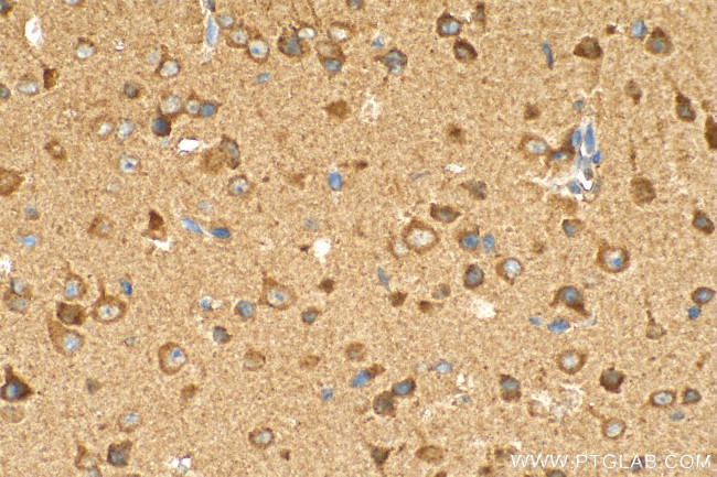 ZNT4 Antibody in Immunohistochemistry (Paraffin) (IHC (P))