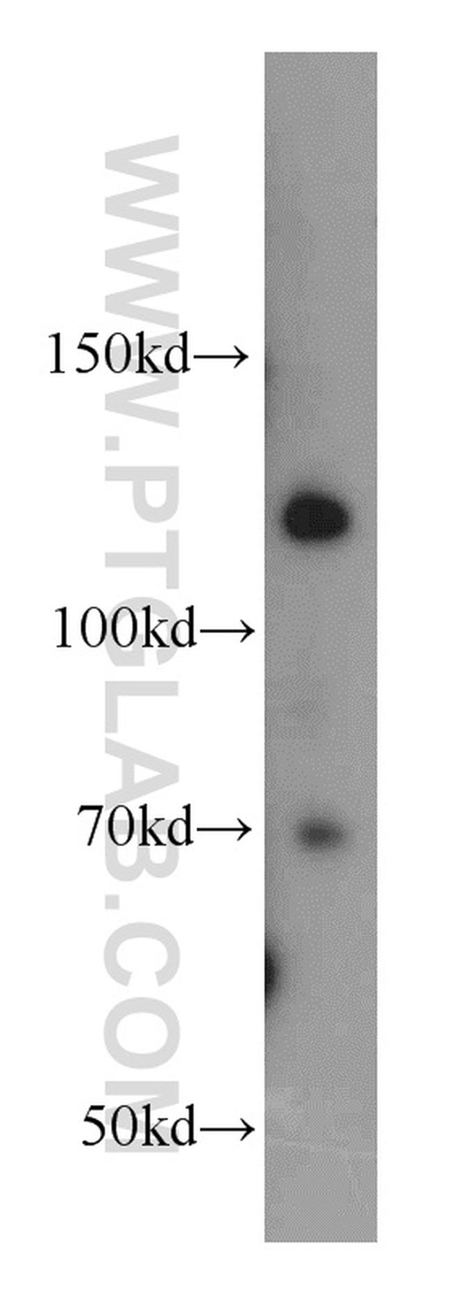 RBBP8 Antibody in Western Blot (WB)
