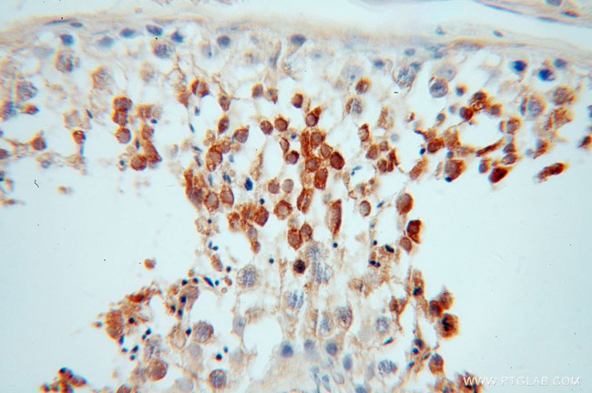 PABPC3 Antibody in Immunohistochemistry (Paraffin) (IHC (P))