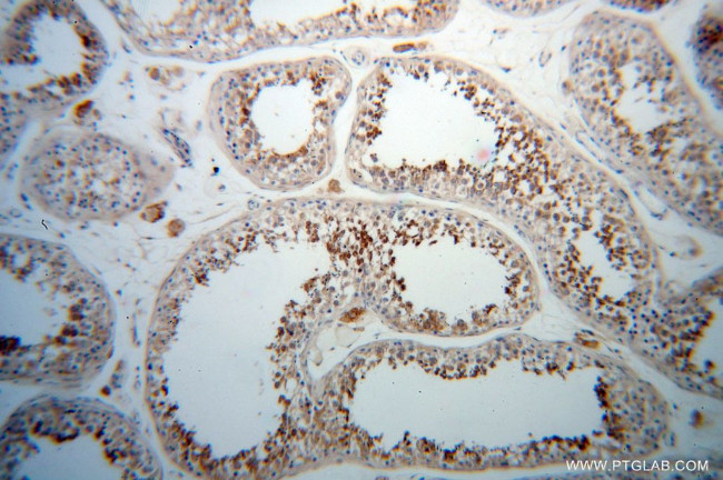 PABPC3 Antibody in Immunohistochemistry (Paraffin) (IHC (P))