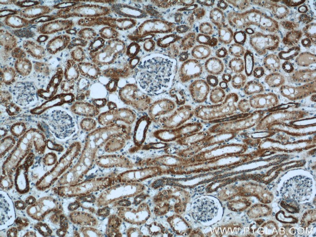 SUCLA2 Antibody in Immunohistochemistry (Paraffin) (IHC (P))