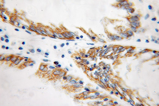 SUCLA2 Antibody in Immunohistochemistry (Paraffin) (IHC (P))